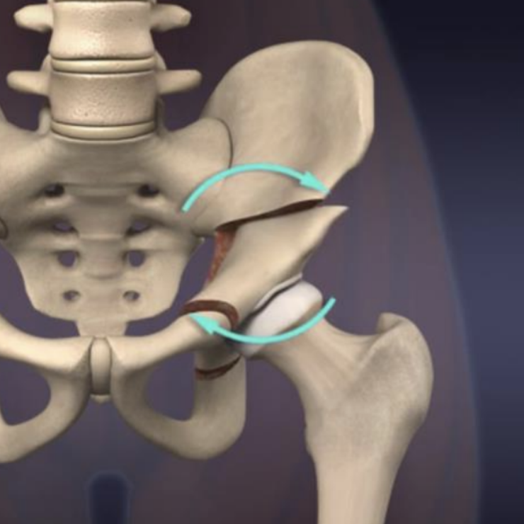 PAO animation of repositioned fragment