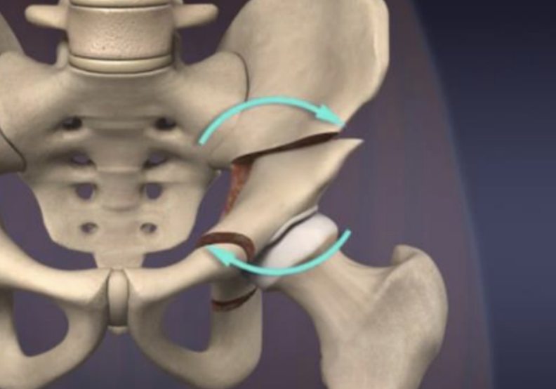 PAO animation of repositioned fragment